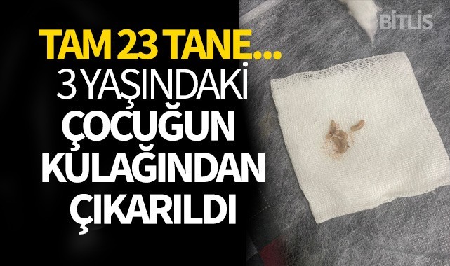 3 yaşındaki çocuğun kulağından çıkarıldı... Tam 23 tane..