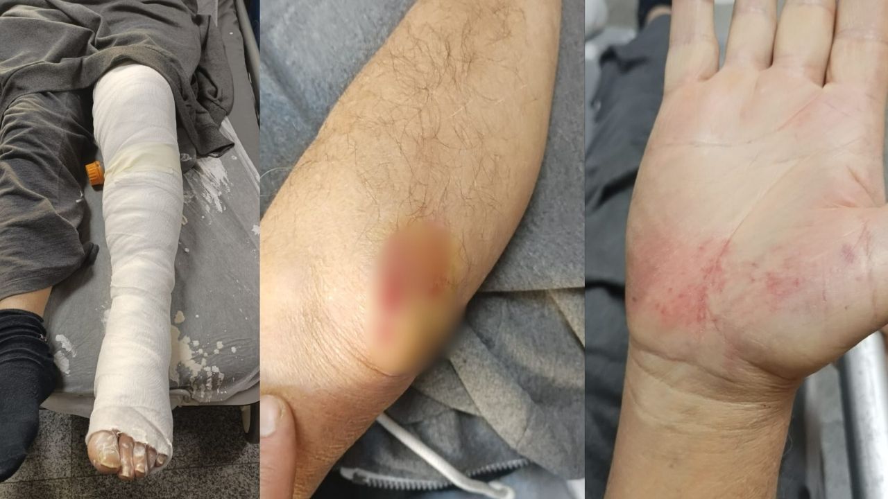 Turgutlu'da okul önündeki kırık dubalar can yaktı