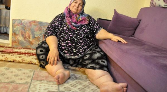 Eşi ölünce hayata küstü, 180 kilo oldu