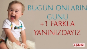 “DOWN SENDROMU GENETİK FARKLILIKTIR HASTALIK DEĞİLDİR”