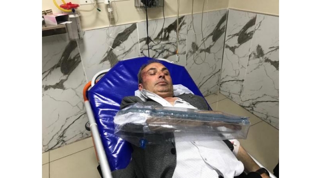 Belediyede işten çıkarılan 2 kişi Başkan Yardımcısını darp etti