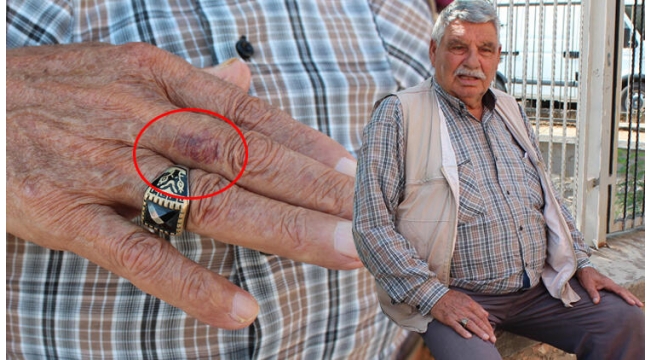 Koynundaki kırkayakla sabahladı