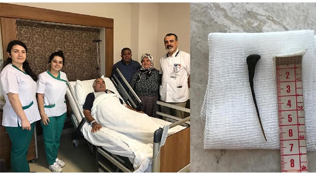 Karın ağrısı şikayetinin nedeni balık kılçığı çıktı