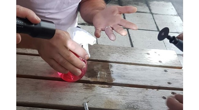Parmağında sıkışan yüzüğü itfaiye çıkardı
