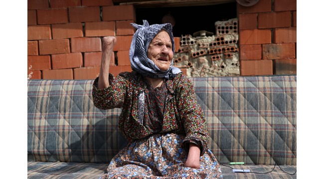 72 yıl önce eşinden gördüğü şiddette elleri kesilen kadın yakınlarının yardımıyla yaşama tutunuyor