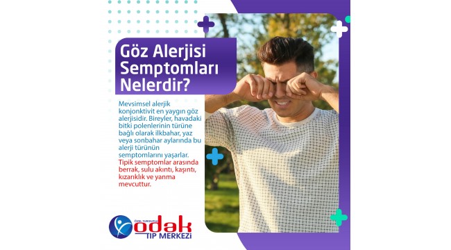 Göz alerjisi semptomları nelerdir?