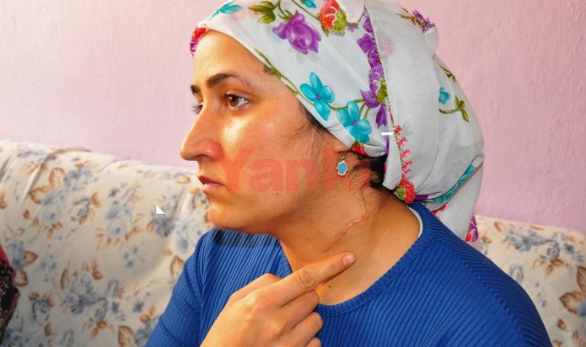 Eşi tarafından boğazı falçatayla kesilerek yaralanan Esra'ya haciz şoku