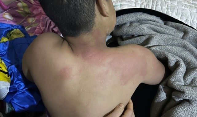 Seçim bürosuna gelen çocuğu kaynar çayla yaktı, tutuklandı. 