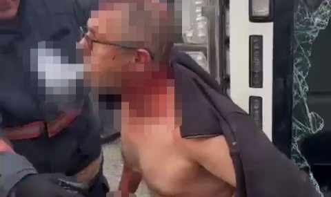 Devirdiği kamyon D-650'i kapattı: Yaralı sürücü sıkıştığı yerden sigara içerek çıktı 
