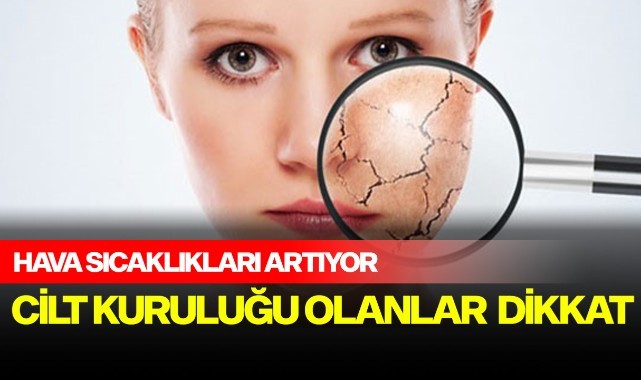  Hava sıcaklıkları artıyor, cilt kuruluğu olanlar dikkat