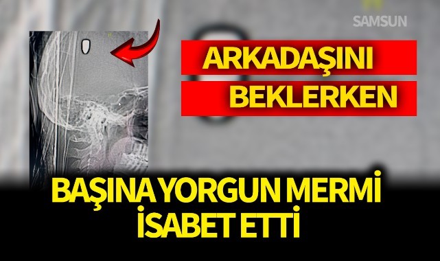 Arkadaşını beklerken kafasına yorgun mermi isabet etti