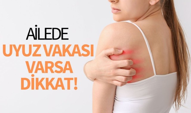Ailede uyuz vakası varsa dikkat