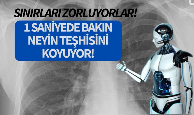 Sınırları zorluyorlar: 1 saniyede teşhis!