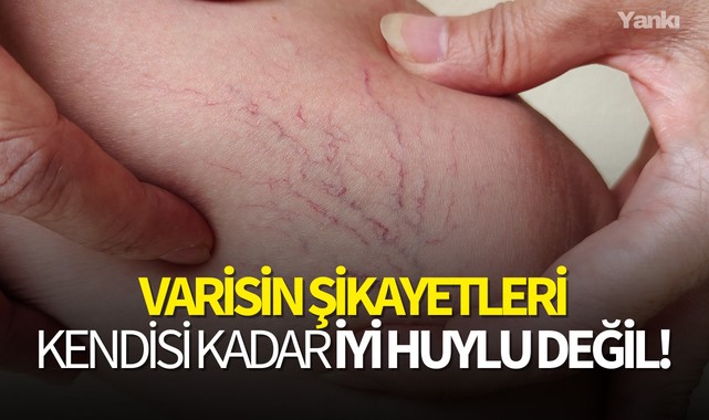 Varisin şikayetleri kendisi kadar iyi huylu değil!