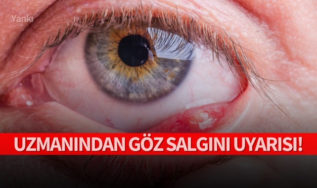 Uzmanından göz salgını uyarısı!