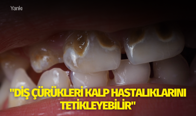 "Diş çürükleri kalp hastalıklarını tetikleyebilir"