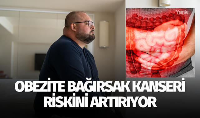 Obezite bağırsak kanseri riskini artırıyor