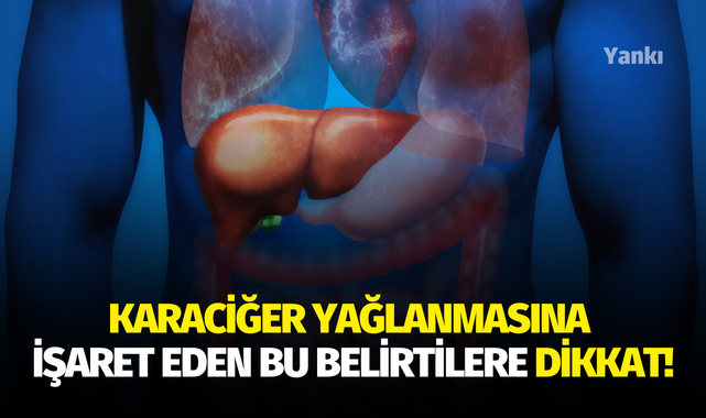 Karaciğer yağlanmasına işaret eden bu belirtilere dikkat