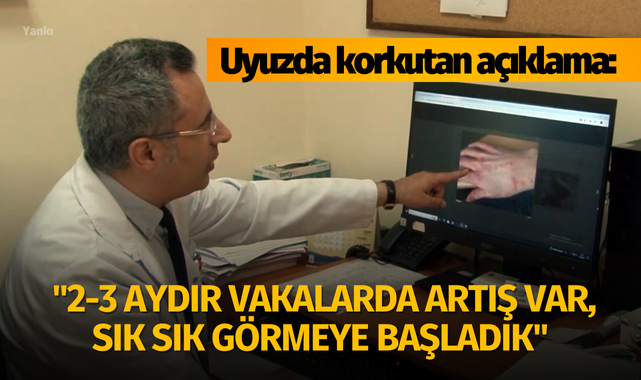 Uyuzda korkutan açıklama: "2-3 aydır vakalarda artış var, sık sık görmeye başladık"
