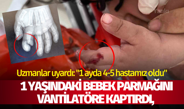 1 yaşındaki bebek parmağını vantilatöre kaptırdı, uzmanlar uyardı: "1 ayda 4-5 hastamız oldu"