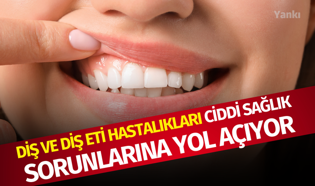 Diş ve diş eti hastalıkları ciddi sağlık sorunlarına yol açıyor