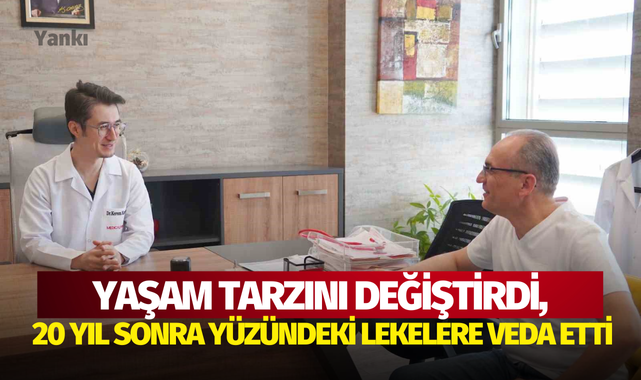 Yaşam tarzını değiştirdi, 20 yıl sonra yüzündeki lekelere veda etti