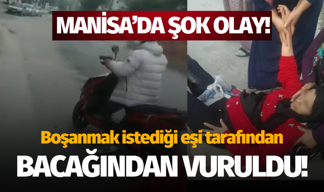 Boşanmak istediği eşi tarafından bacağından vuruldu