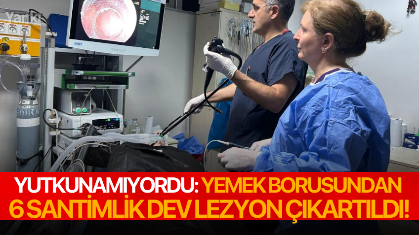 Manisalı kadının yemek borusundan  6 santimlik lezyon çıktı!