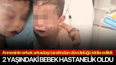 Annesinin erkek arkadaşı tarafından dövüldüğü iddia edildi: 2 yaşındaki bebek hastanelik oldu