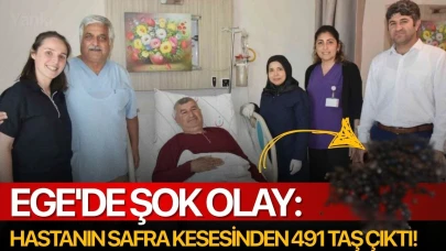 Ege'de şok olay: Hastanın safra kesesinden 491 taş çıktı!