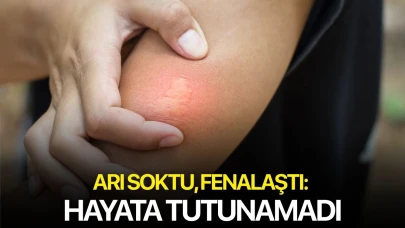 Arı soktu, fenalaştı: Hayata tutunamadı