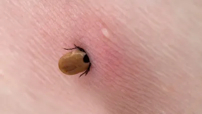 Yaz aylarında kene vakaları artıyor