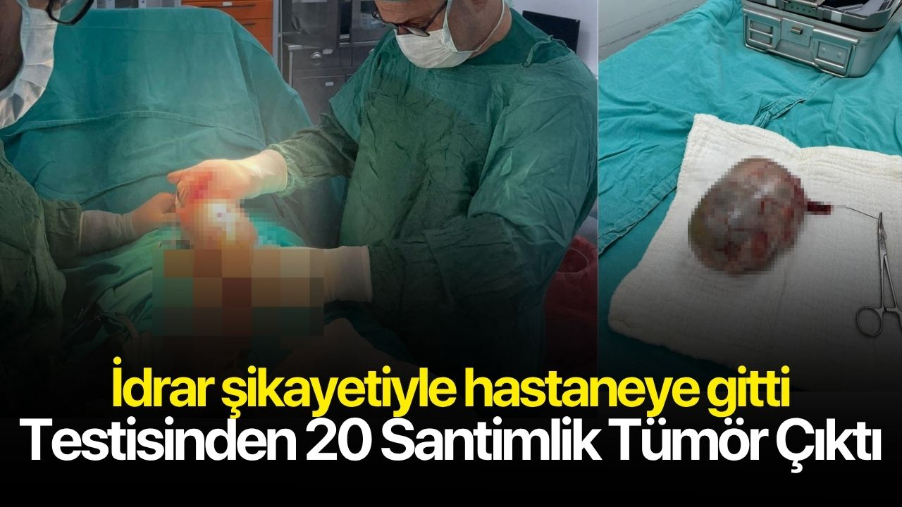Testisinde 20 santimlik tümör çıktı