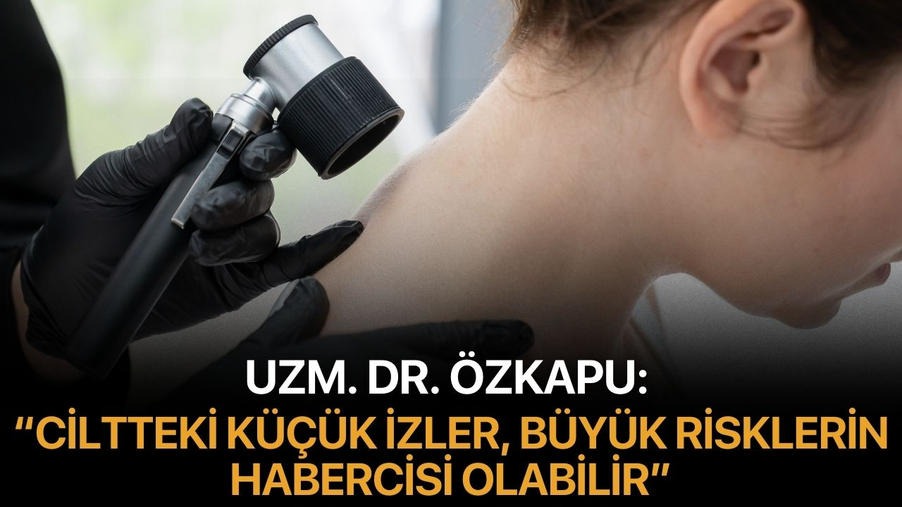 Uzm. Dr.Özkapu:  "Ciltteki Küçük İzler, Büyük Risklerin Habercisi Olabilir"