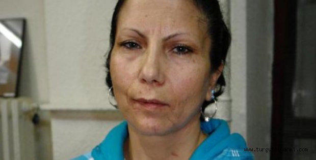 Şiddet mağdurundan Başbakan ve Milletvekillerine çağrı