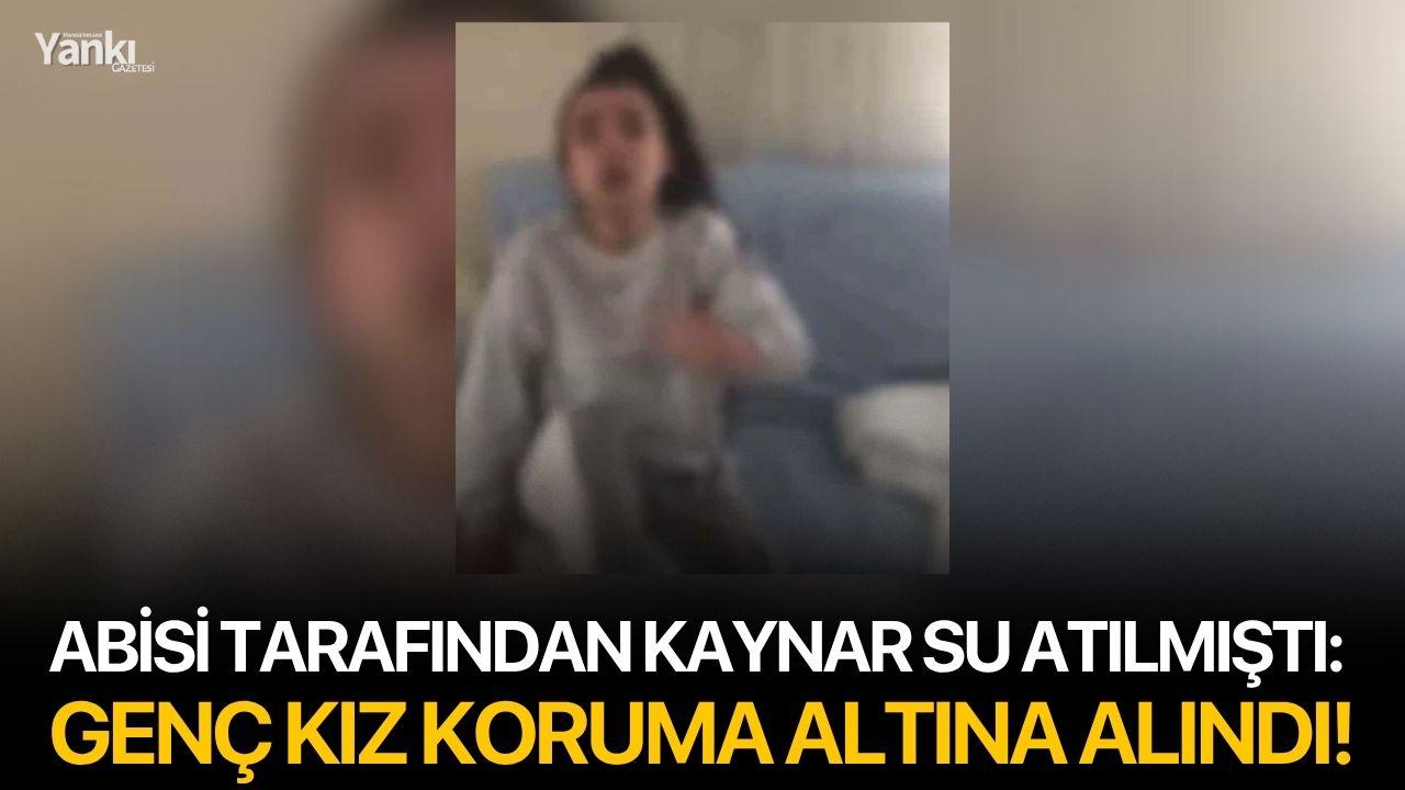 Abisi tarafından kaynar su atılmıştı: Genç kız koruma altına alındı!