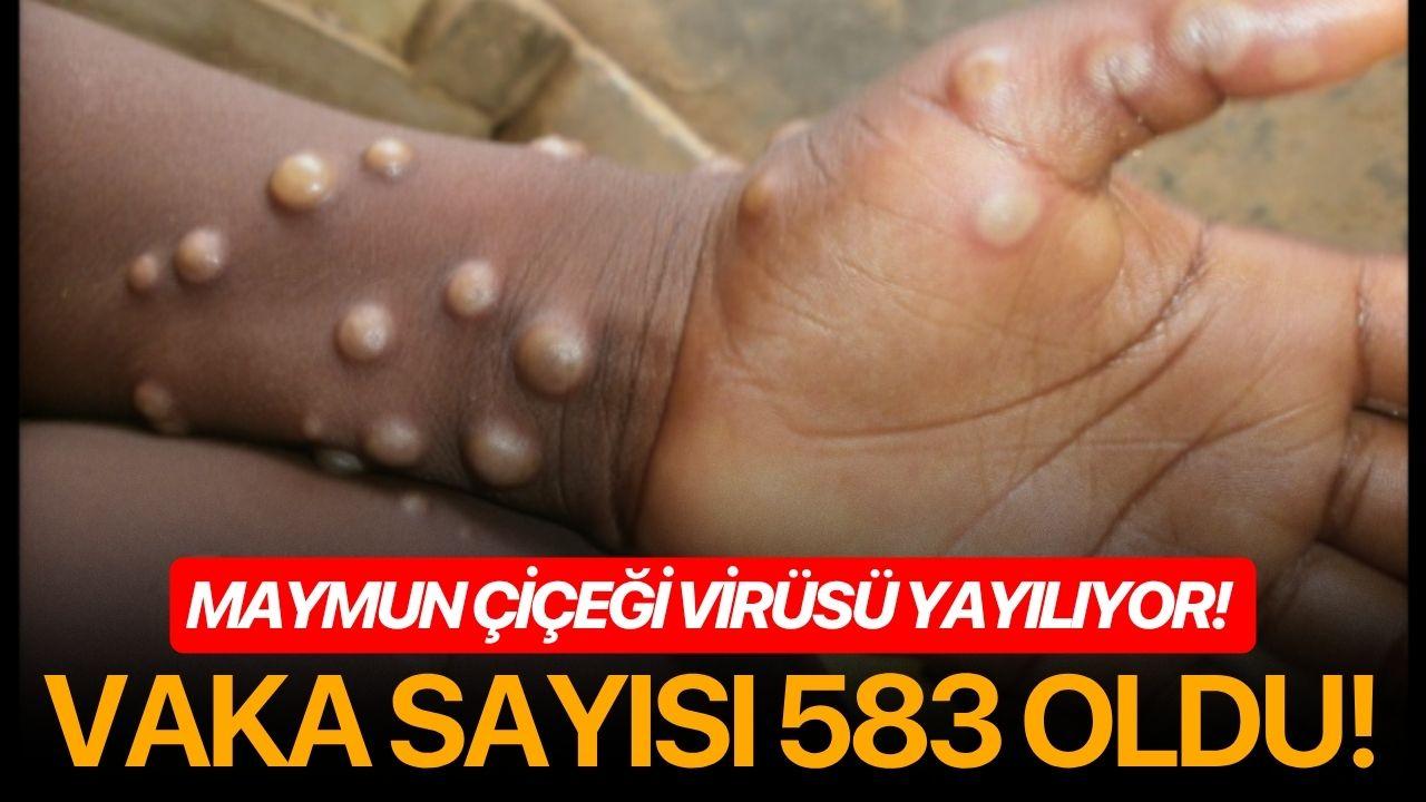 Maymun çiçeği virüsü yayılıyor!