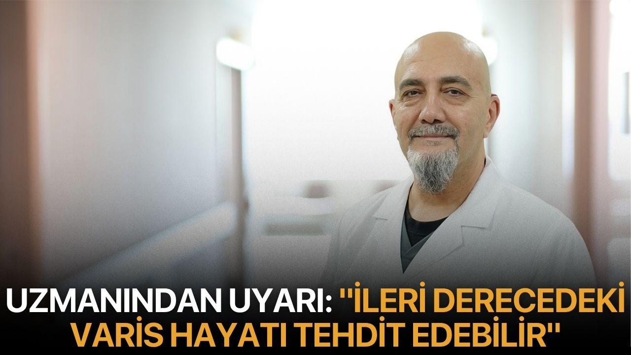 Uzmanından uyarı: "İleri derecedeki varis hayatı tehdit edebilir"