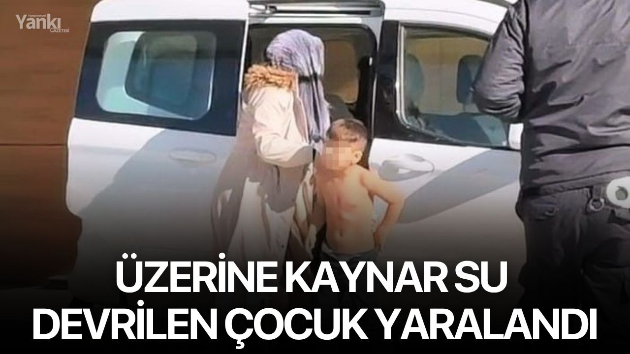 Üzerine kaynar su devrilen çocuk yaralandı