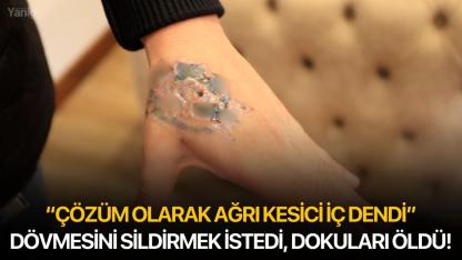 Dövmesini sildirmek istedi, dokuları öldü!