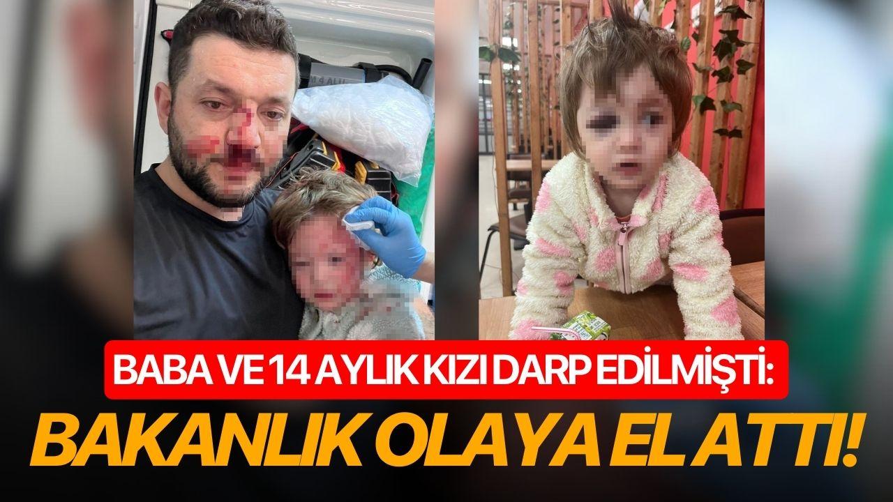 Baba ve 14 Aylık kızı darp edilmişti: Bakanlık olaya el attı!