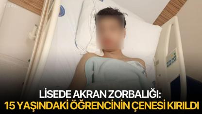 Lisede akran zorbalığı:  15 yaşındaki öğrencinin çenesi kırıldı