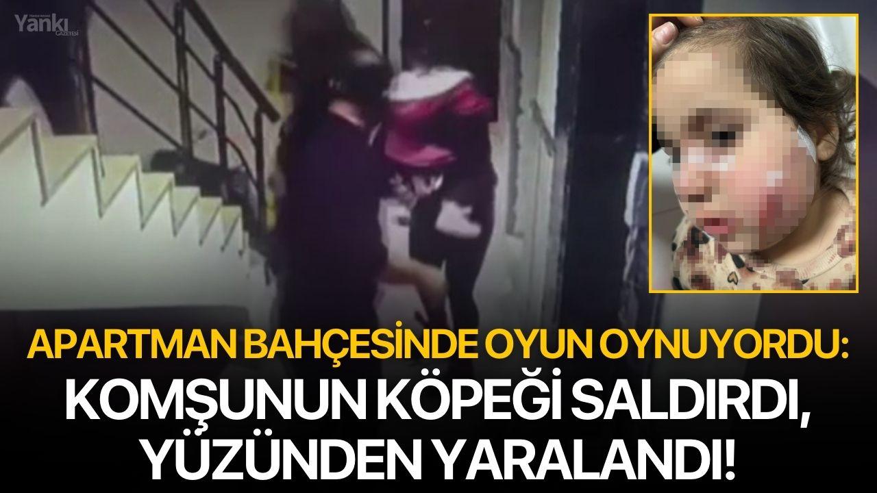 Apartman bahçesinde oyun oynuyordu: Komşunun köpeği saldırdı, yüzünden yaralandı!