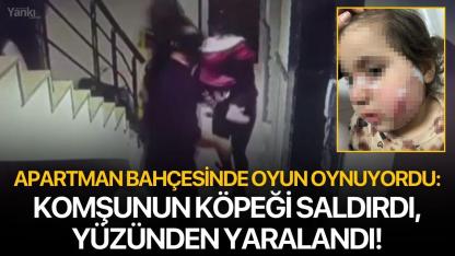 Apartman bahçesinde oyun oynuyordu: Komşunun köpeği saldırdı, yüzünden yaralandı!