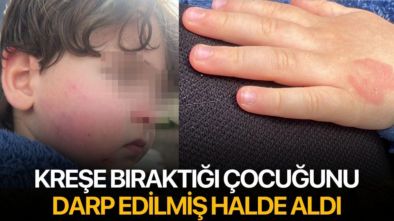 Kreşe bıraktığı çocuğunu darp edilmiş halde aldı