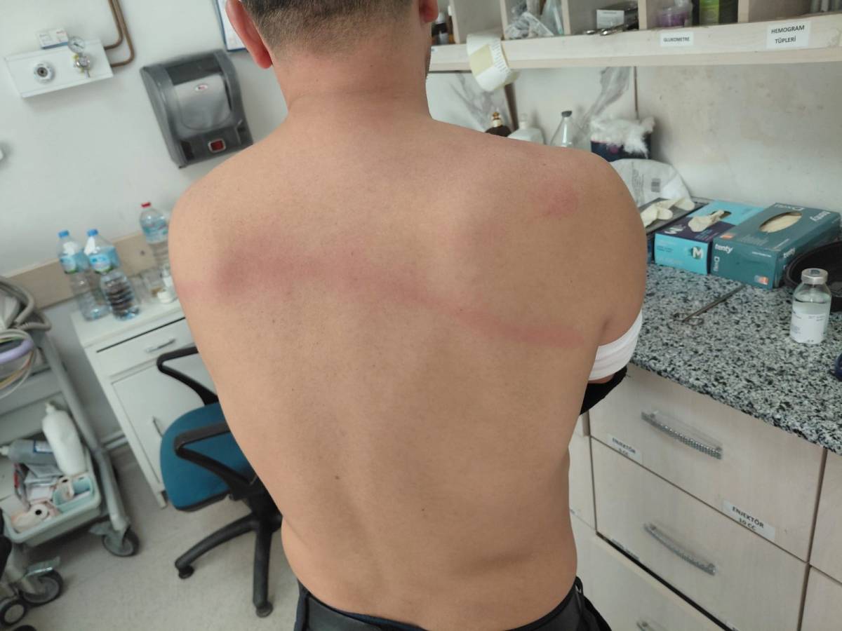 Akıl almaz iddia! 'Belediye Başkanı Zabıtaları Sopayla Dövdü'