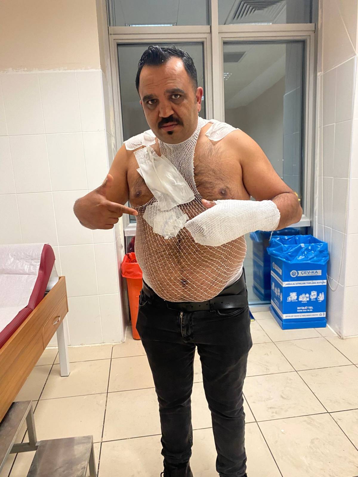 Tostçu şov yapmak isterken kendini yaktı: O anlar kamerada!